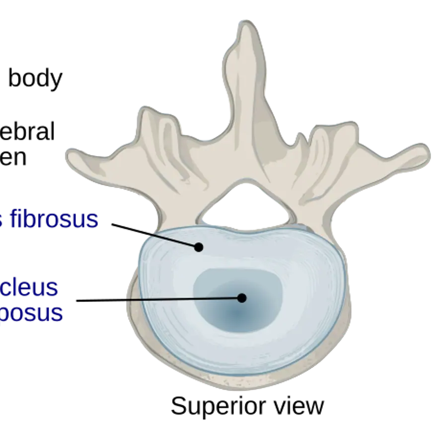Vertebral discs — visual reference
