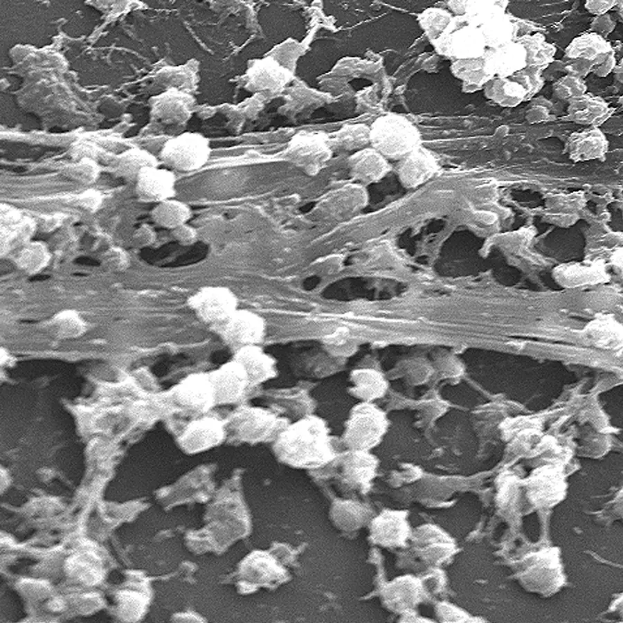 Bacterial biofilms — visual reference