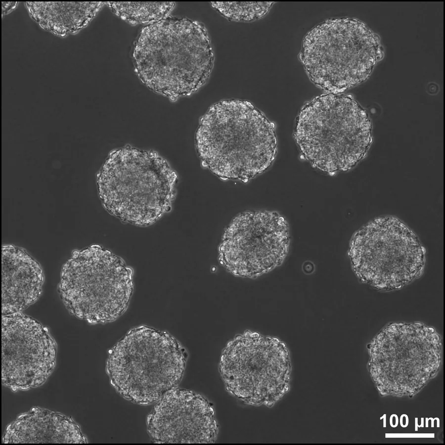 Embryoid bodies — visual reference