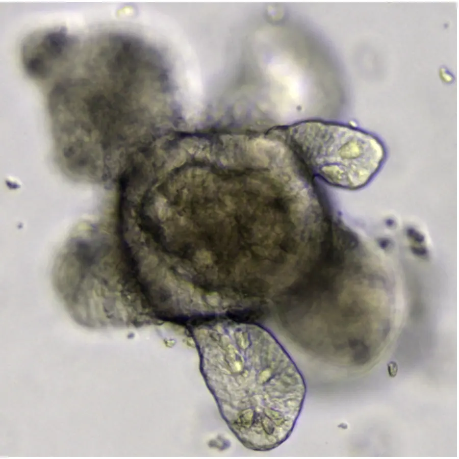 Organoids — visual reference